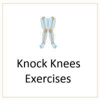 Knock Knees Exercises on 9Apps