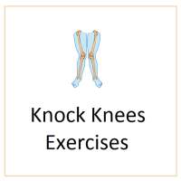 Knock Knees Exercises