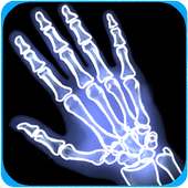 X-ray Scanner Prank on 9Apps