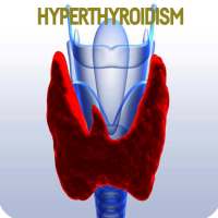 Hyperthyroidism Disease