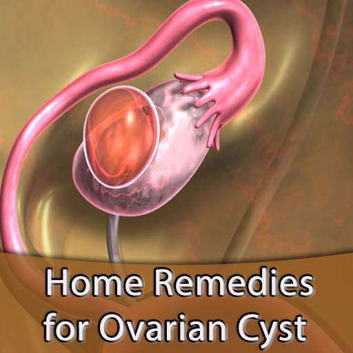 Home Remedies for Ovarian Cyst