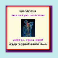 Spondylosis Spondylitis on 9Apps