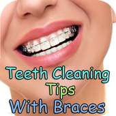 Teeth Cleaning Tips With Braces on 9Apps