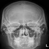 Human X-ray Anatomy - Lite