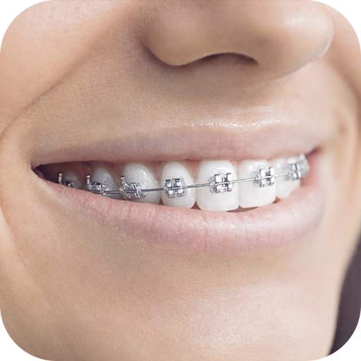 Teeth Braces Photo Maker- Braces Camera Editor