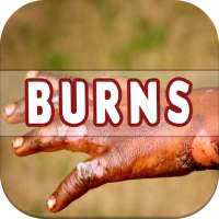 Burns: Causes, Diagnosis, and Management