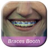 Braces Photo – Free Editor on 9Apps