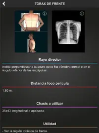 Anatomía Rx Simple Lumbar 