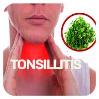 Tonsillitis Infection on 9Apps