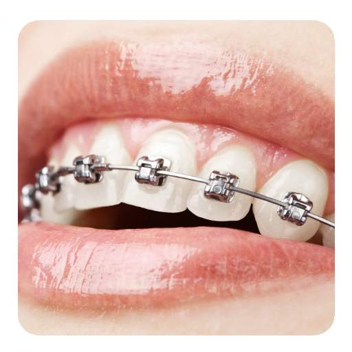 orthodontist guide