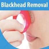 Blackhead Removal