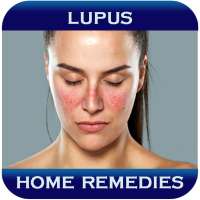 Home Remedies For Lupus on 9Apps