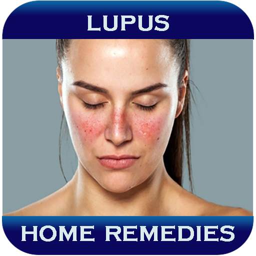 Home Remedies For Lupus