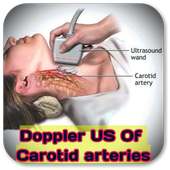 Doppler Ultrasound Of Carotid arteries