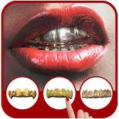 Gold Teeth Grillz on 9Apps