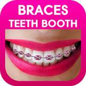 Braces Photo Editor on 9Apps