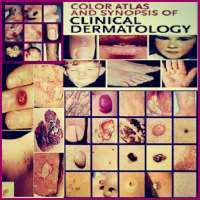 Color Atlas of Skin Diseases - Dermatology Atlas