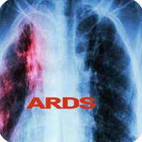 Acute Respiratory Distress Syndrom on 9Apps