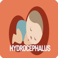 Hydrocephalus Disease on 9Apps