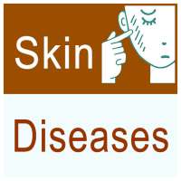 skin disease and treatment