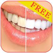 Teeth Cleaning tips on 9Apps