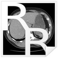 RadRevision: Anatomy on CT