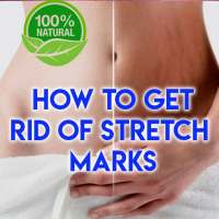 How To Get Rid Of Stretch Marks on 9Apps