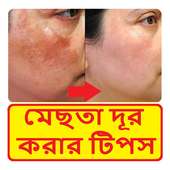 মেছতা দূর করার টিপস ~ Face Treatment