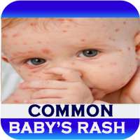 Baby's Rash Guide