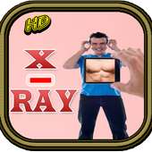 X-Ray Camera Hd simulated