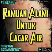 Ramuan Alami Untuk Cacar Air on 9Apps