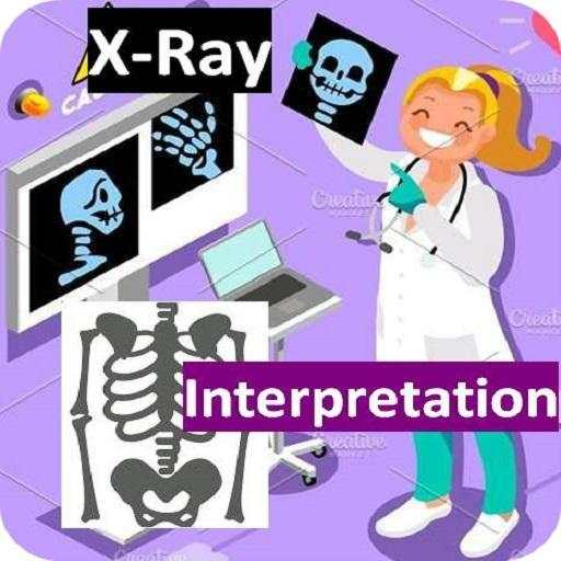 X-Ray Interpretation