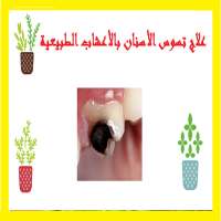 علاج تسوس الأسنان بالأعشاب الطبيعية on 9Apps