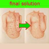 psoriasis solution