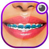 Braces beauty Selfie Camera