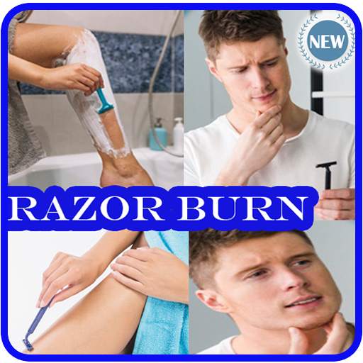 Razor Burn