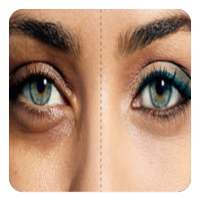 how to remove dark circles  (Guide)