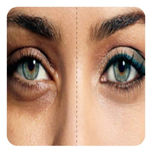 how to remove dark circles  (Guide)