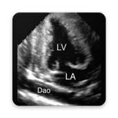 ECHOCARDIOGRAPHY GUIDE