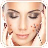 Pimple Remover Tips on 9Apps