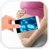 X-Ray Pregnant simulated on 9Apps