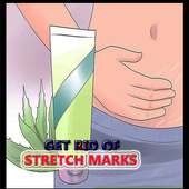 Get Rid Of Stretch Marks Naturally