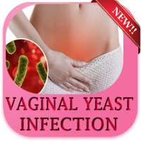 Vaginal Yeast Infection on 9Apps