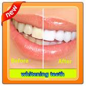 teeth whitening bleach on 9Apps