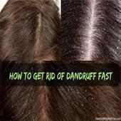 Get Rid Of Dandruff on 9Apps