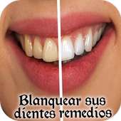 Como blanquear dientes fácil