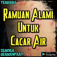 Ramuan Herbal Cacar Air Paling Mujarab on 9Apps