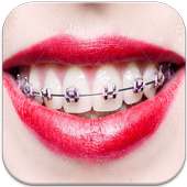 Real Braces Teeth Booth Camera on 9Apps