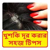 খুশকি দূর করার সহজ টিপস ~  Dandruff removing Tips