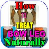 How To Fix Bow Legs Naturally